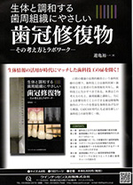 生体と調和する歯周組織にやさしい歯冠修復物