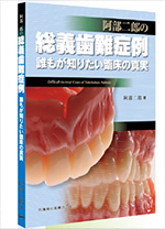 総義歯難症例 誰もが知りたい臨床の真実